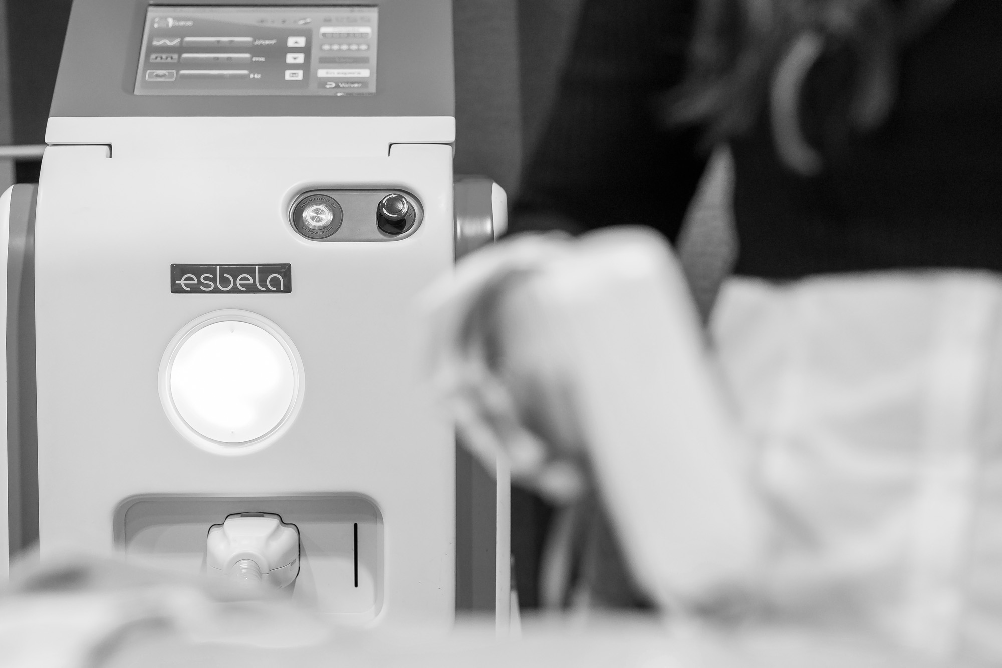 depilación-laser-diodo-donbenito