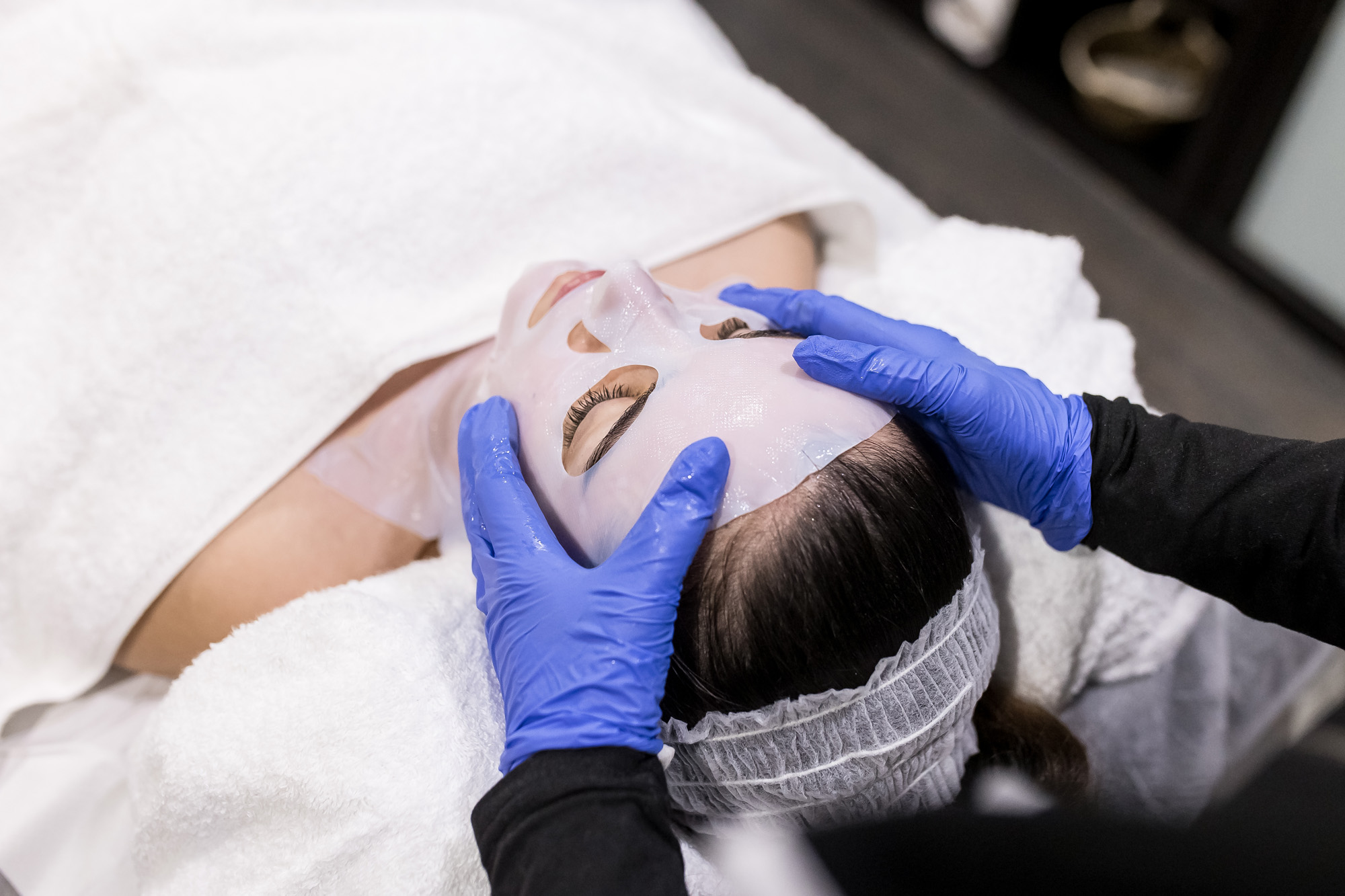 peeling-quimico-don-benito